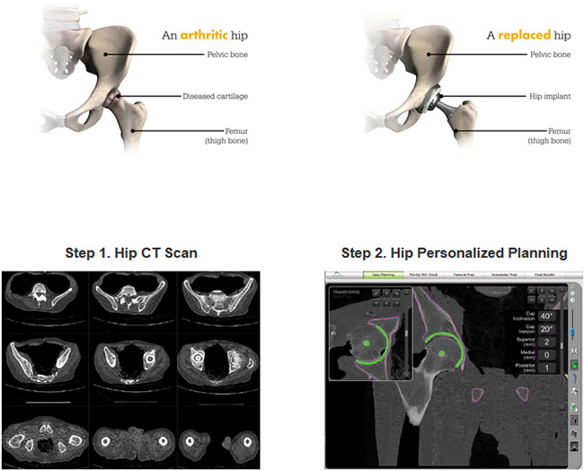 Robotic Assisted Surgery