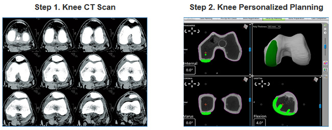 Robotic Assisted Surgery