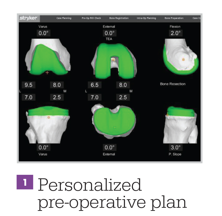 Robotic Assisted Surgery